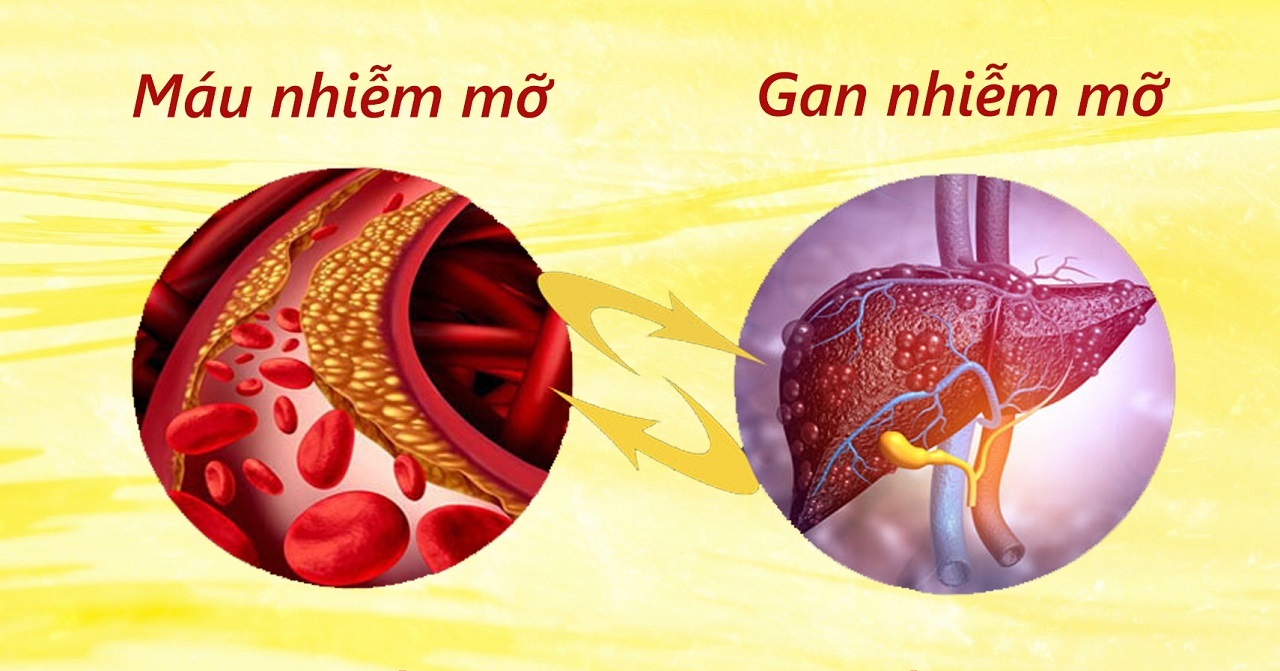 Ăn gì giảm mỡ máu và gan nhiễm mỡ?